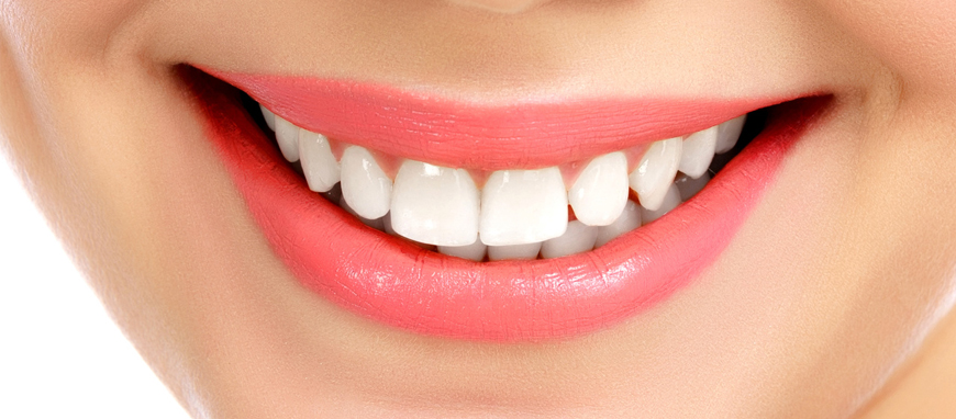 Teeth Whitening Dentist in India